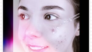 produk perawatan kulit untuk menghilangkan jerawat image